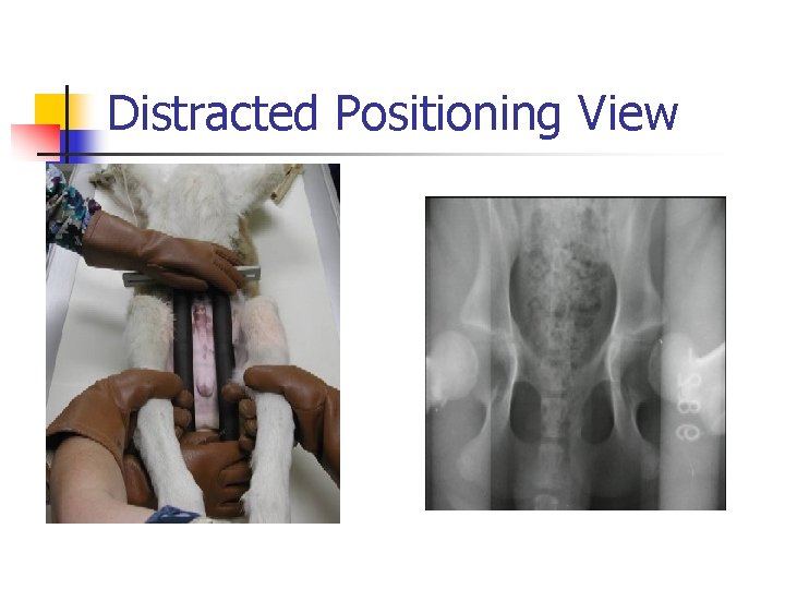 Distracted Positioning View 