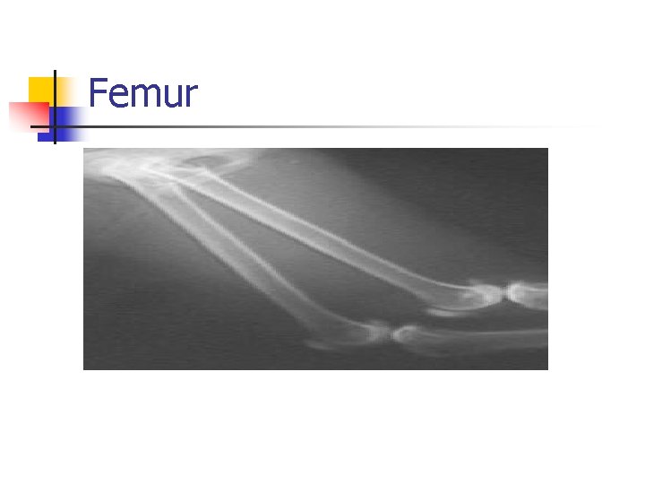 Femur 