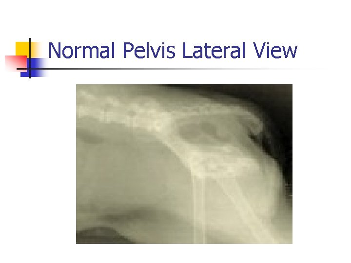 Normal Pelvis Lateral View 