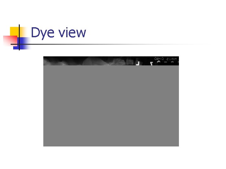 Dye view 