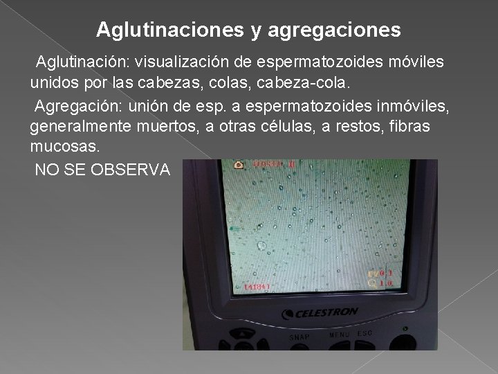 Aglutinaciones y agregaciones Aglutinación: visualización de espermatozoides móviles unidos por las cabezas, colas, cabeza-cola.