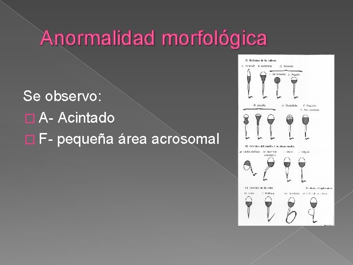 Anormalidad morfológica Se observo: � A- Acintado � F- pequeña área acrosomal 