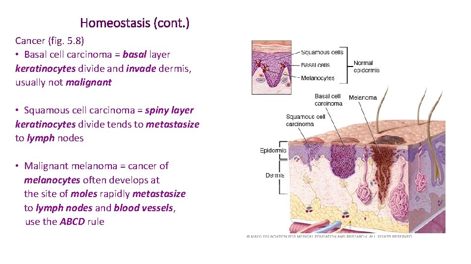 Homeostasis (cont. ) Cancer (fig. 5. 8) • Basal cell carcinoma = basal layer