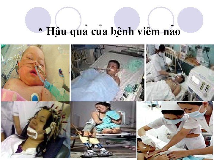 * Hâ u qua cu a bê nh viêm na o Trường Tiểu học