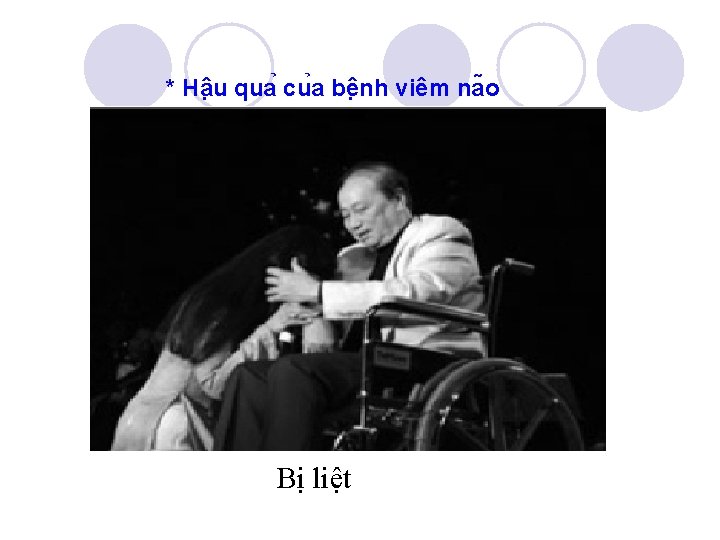 * Hâ u qua cu a bê nh viêm na o Bị liệt 