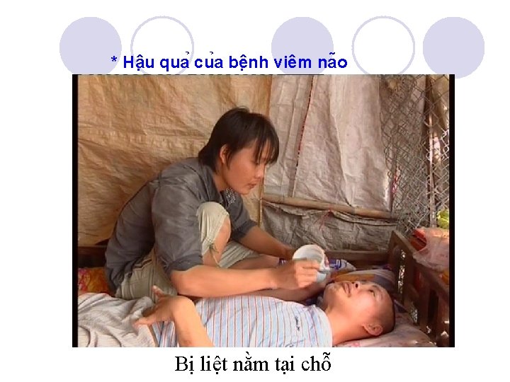 * Hâ u qua cu a bê nh viêm na o Bị liệt nằm