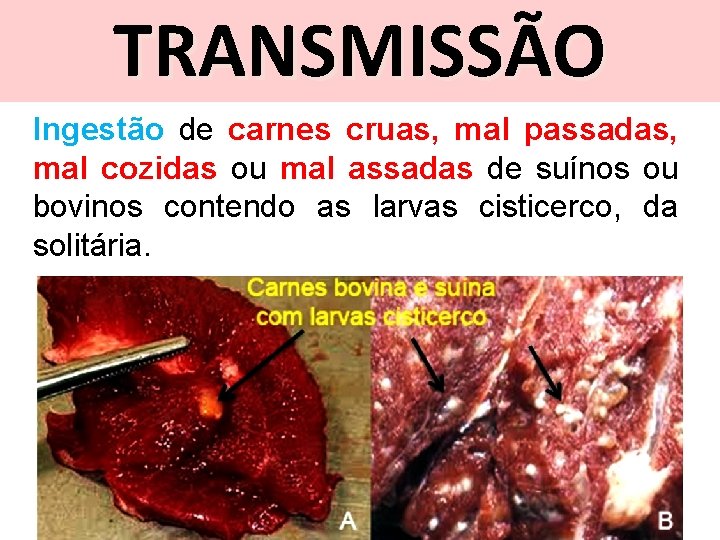 TRANSMISSÃO Ingestão de carnes cruas, mal passadas, mal cozidas ou mal assadas de suínos