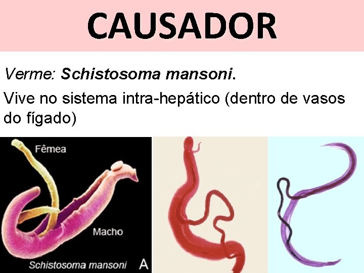 CAUSADOR Verme: Schistosoma mansoni. Vive no sistema intra-hepático (dentro de vasos do fígado) 