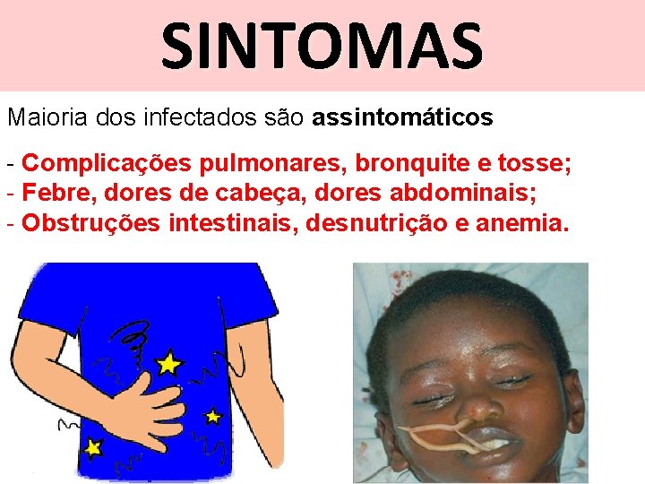 SINTOMAS Maioria dos infectados são assintomáticos - Complicações pulmonares, bronquite e tosse; - Febre,