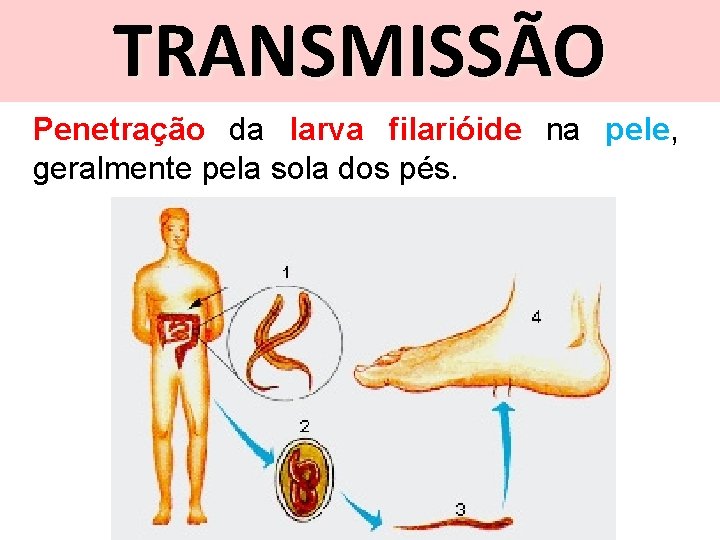 TRANSMISSÃO Penetração da larva filarióide na pele, geralmente pela sola dos pés. 