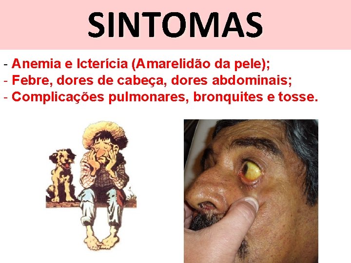 SINTOMAS - Anemia e Icterícia (Amarelidão da pele); - Febre, dores de cabeça, dores