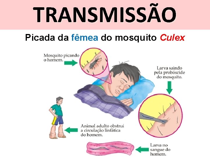 TRANSMISSÃO Picada da fêmea do mosquito Culex 