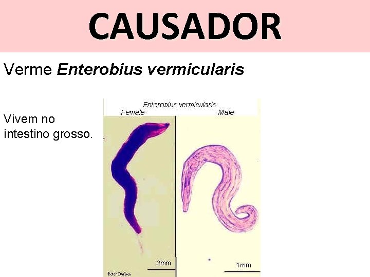 CAUSADOR Verme Enterobius vermicularis Vivem no intestino grosso. 