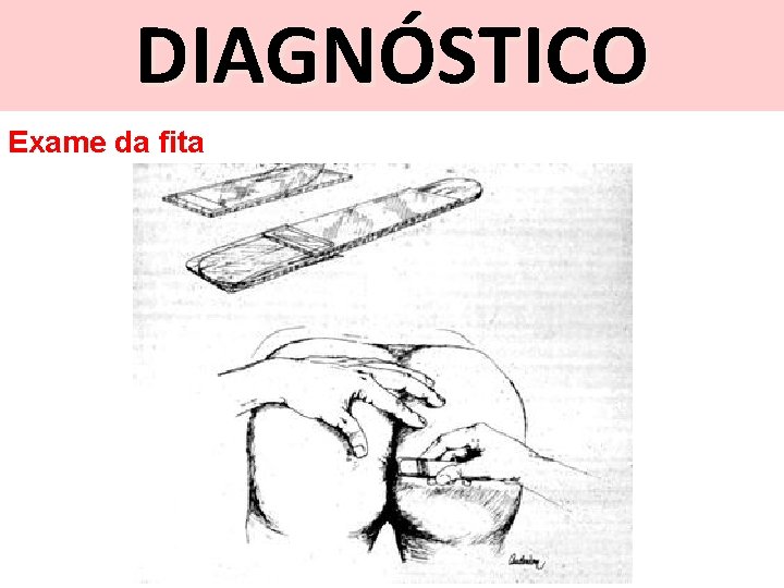 DIAGNÓSTICO Exame da fita 