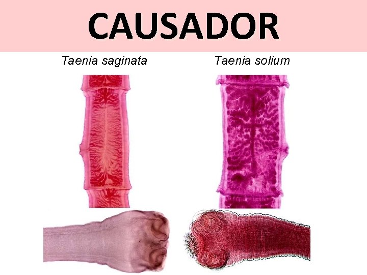 CAUSADOR Taenia saginata Taenia solium 