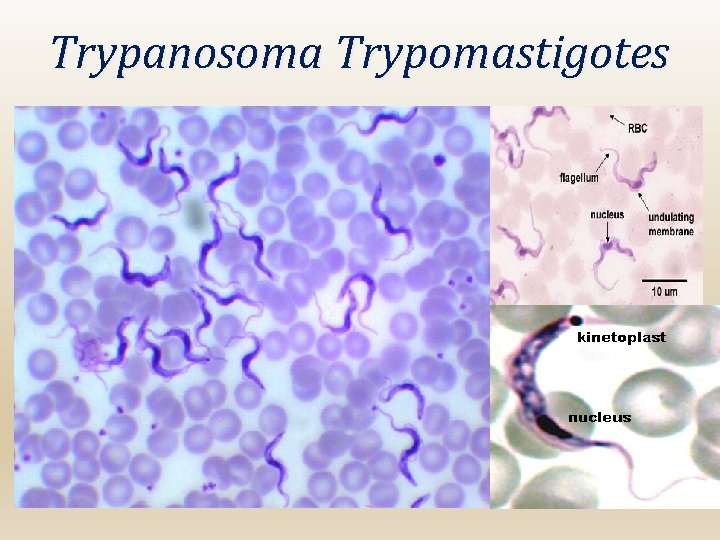 Trypanosoma Trypomastigotes 