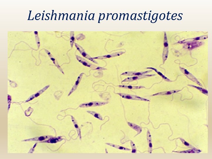 Leishmania promastigotes 