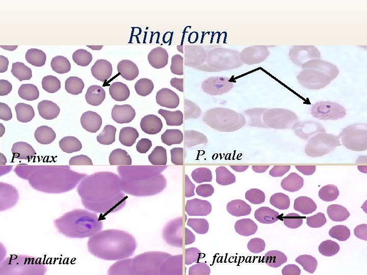 Ring form P. vivax P. ovale P. malariae P. falciparum 
