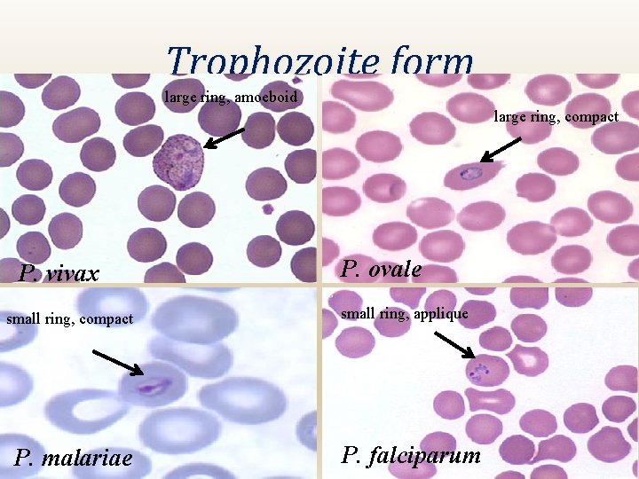 Trophozoite form large ring, amoeboid large ring, compact P. vivax small ring, compact P.