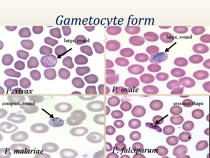 Gametocyte form large, round P. vivax P. ovale compact, round P. malariae crescent shape