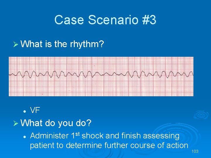 Case Scenario #3 What is the rhythm? l VF What do you do? l