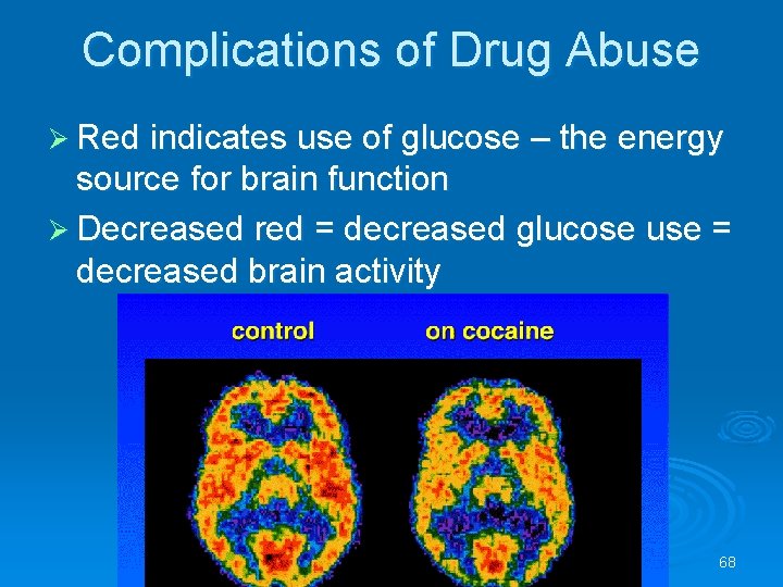 Complications of Drug Abuse Red indicates use of glucose – the energy source for