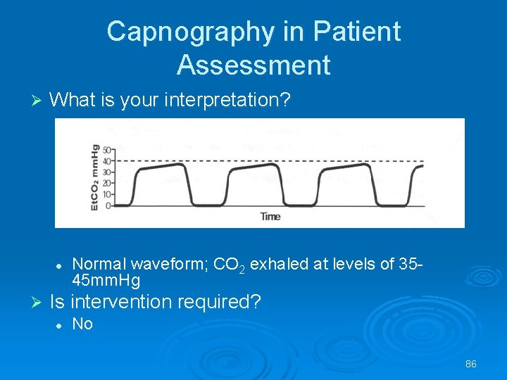 Capnography in Patient Assessment What is your interpretation? l Normal waveform; CO 2 exhaled