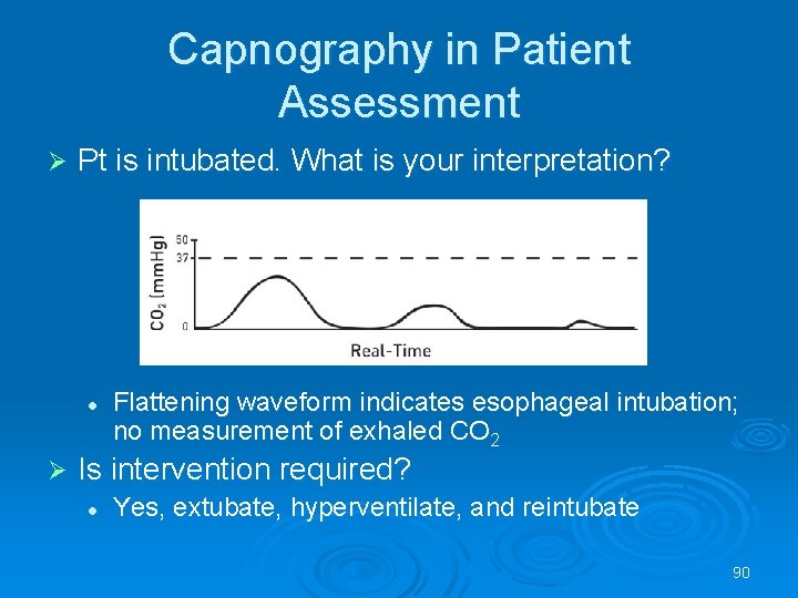 Capnography in Patient Assessment Pt is intubated. What is your interpretation? l Flattening waveform