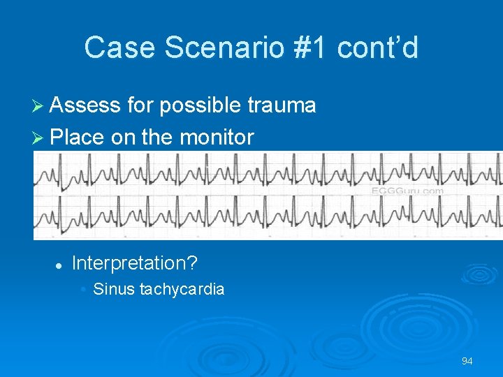 Case Scenario #1 cont’d Assess for possible trauma Place on the monitor l Interpretation?