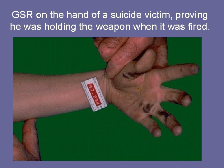 GSR on the hand of a suicide victim, proving he was holding the weapon