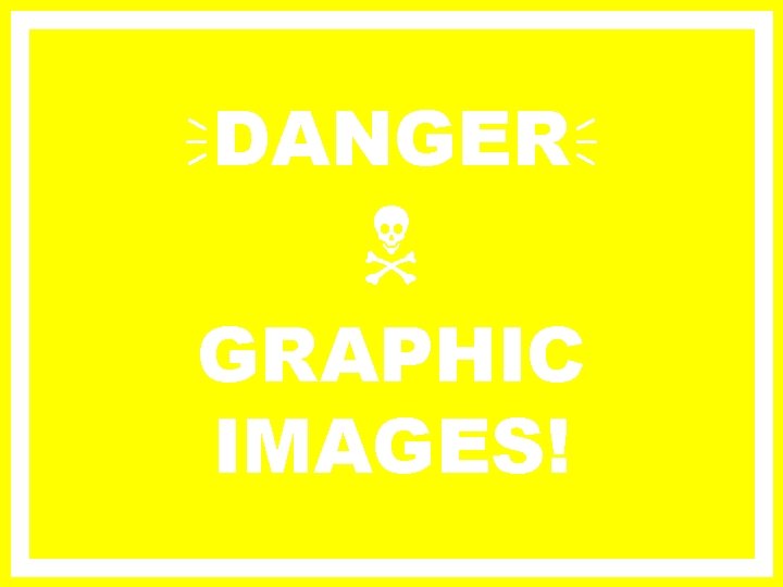  DANGER GRAPHIC IMAGES! 