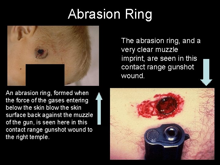 Abrasion Ring The abrasion ring, and a very clear muzzle imprint, are seen in