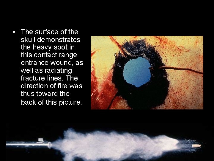  • The surface of the skull demonstrates the heavy soot in this contact