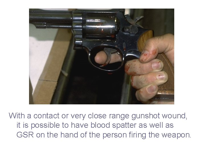 With a contact or very close range gunshot wound, it is possible to have