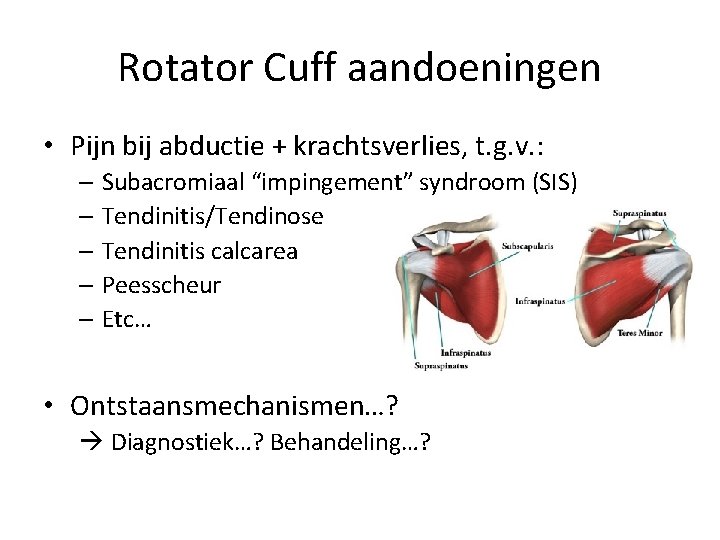 Rotator Cuff aandoeningen • Pijn bij abductie + krachtsverlies, t. g. v. : –