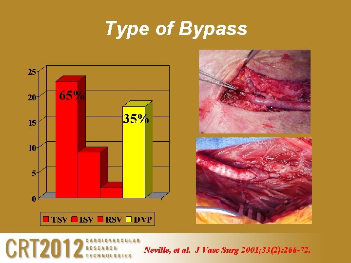 Type of Bypass 65% 35% Neville, et al. J Vasc Surg 2001; 33(2): 266