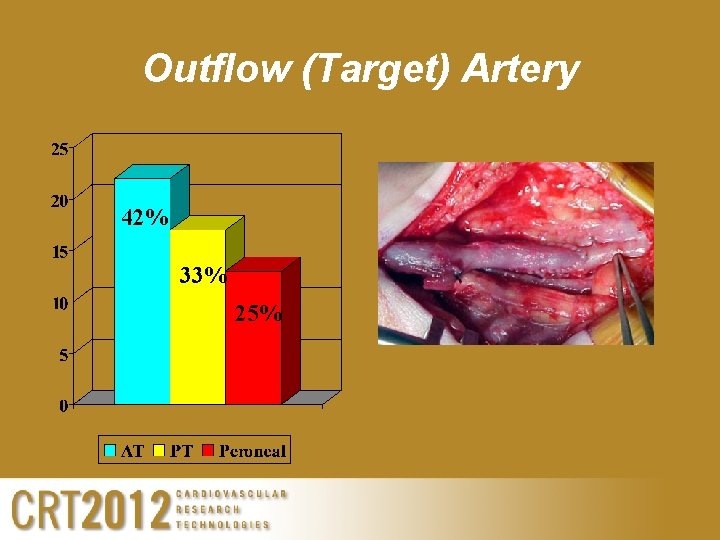 Outflow (Target) Artery 42% 33% 25% 