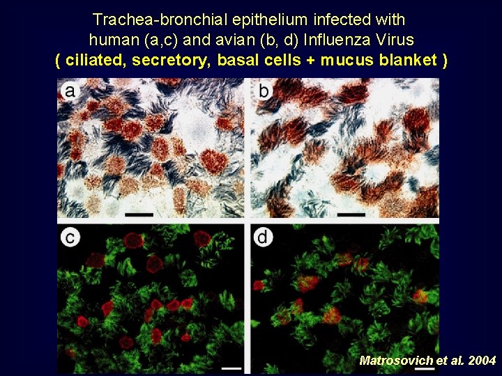 Trachea-bronchial epithelium infected with human (a, c) and avian (b, d) Influenza Virus (