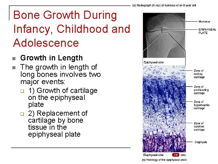 Bone Growth During Infancy, Childhood and Adolescence n n Growth in Length The growth