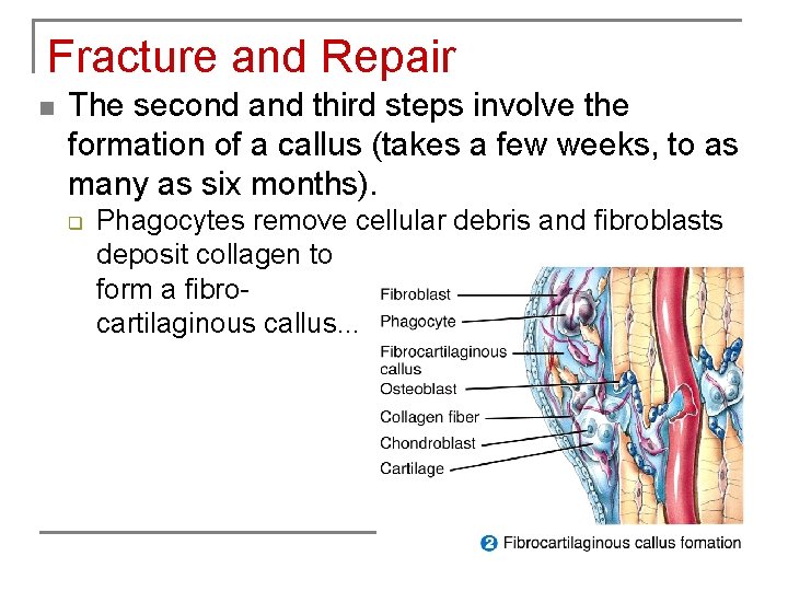 Fracture and Repair n The second and third steps involve the formation of a