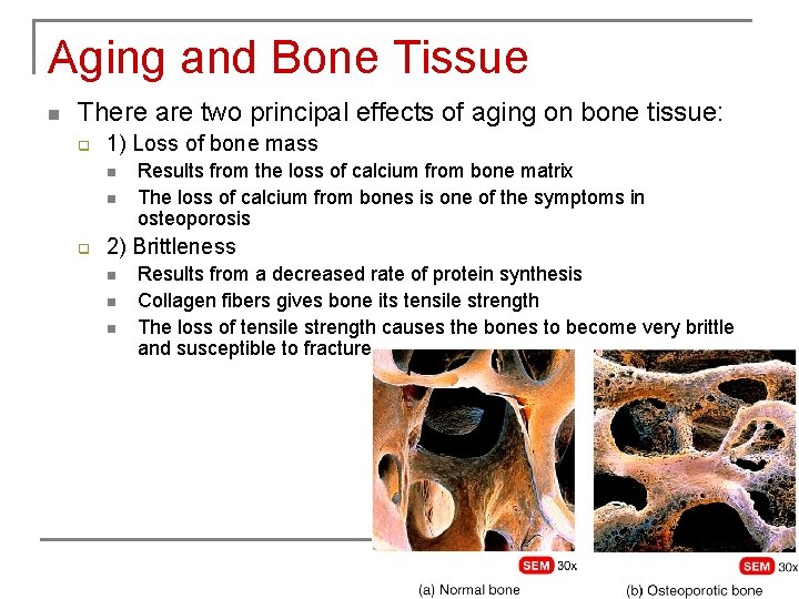 Aging and Bone Tissue n There are two principal effects of aging on bone