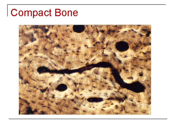 Compact Bone 