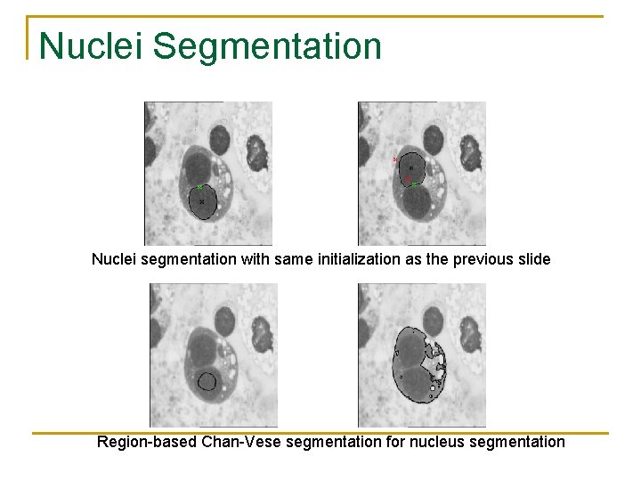 Nuclei Segmentation Nuclei segmentation with same initialization as the previous slide Region-based Chan-Vese segmentation