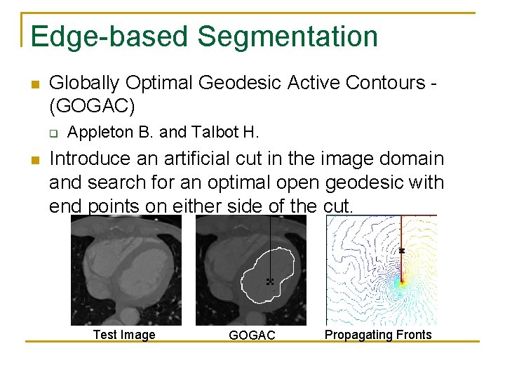 Edge-based Segmentation n Globally Optimal Geodesic Active Contours (GOGAC) q n Appleton B. and