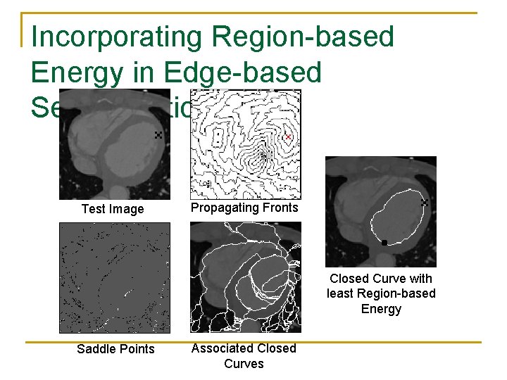 Incorporating Region-based Energy in Edge-based Segmentation Test Image Propagating Fronts Closed Curve with least