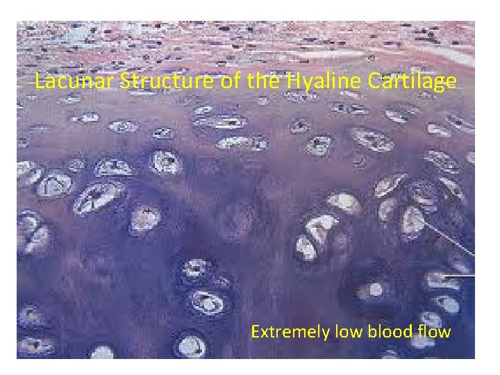 Lacunar Structure of the Hyaline Cartilage Extremely low blood flow 