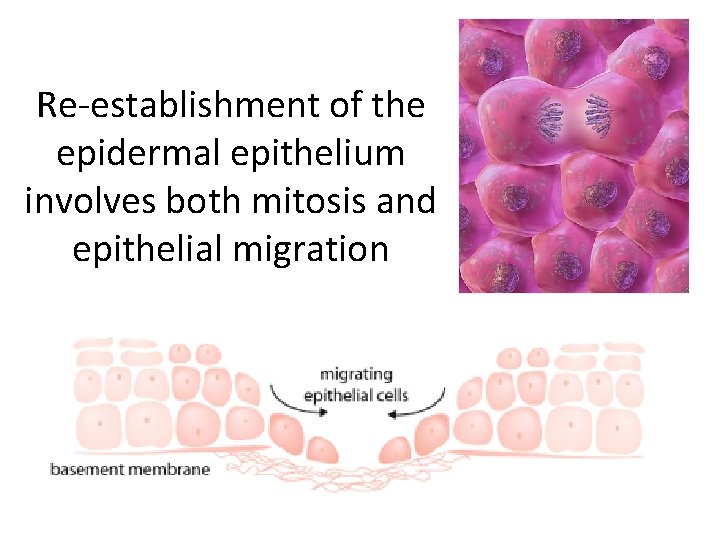 Re-establishment of the epidermal epithelium involves both mitosis and epithelial migration 