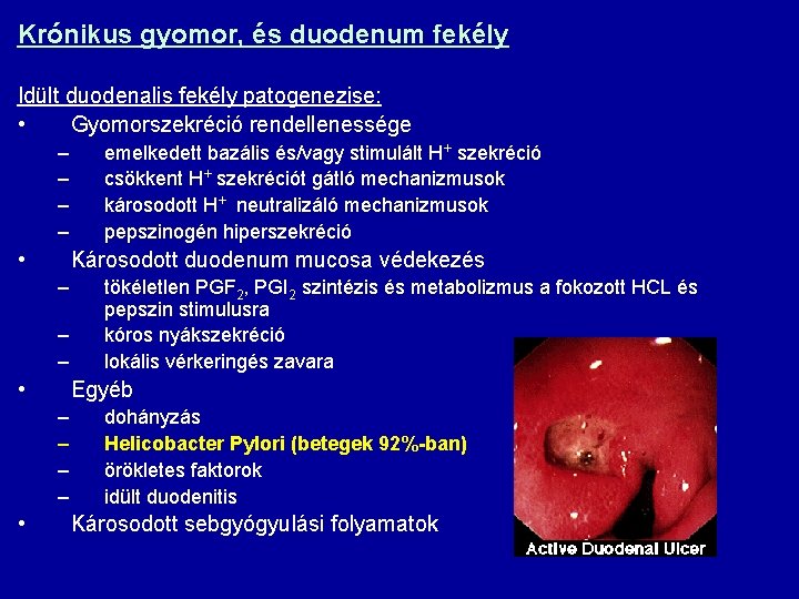 Krónikus gyomor, és duodenum fekély Idült duodenalis fekély patogenezise: • Gyomorszekréció rendellenessége – –