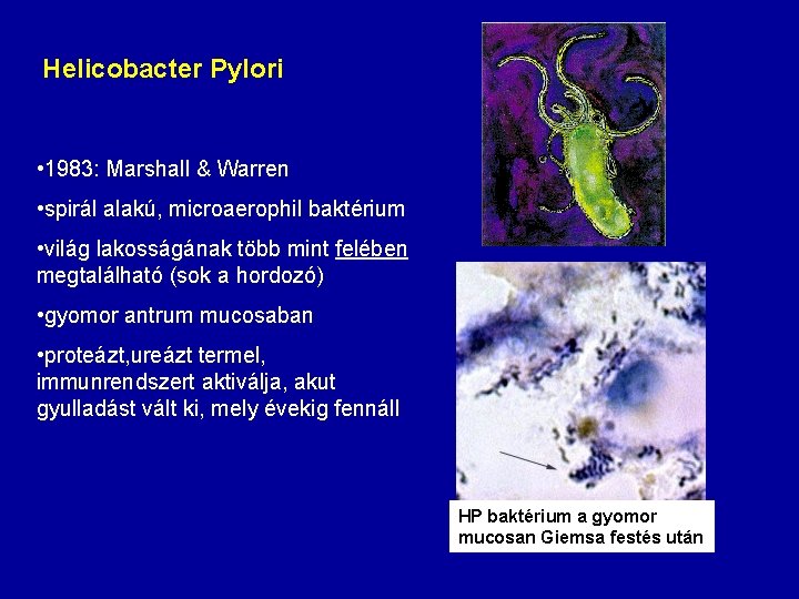 Helicobacter Pylori • 1983: Marshall & Warren • spirál alakú, microaerophil baktérium • világ