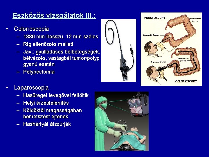 Eszközös vizsgálatok III. : • Colonoscopia – 1880 mm hosszú, 12 mm széles –